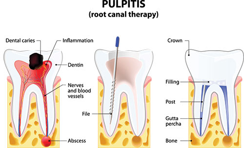 Murrieta Cosmetic Dentist